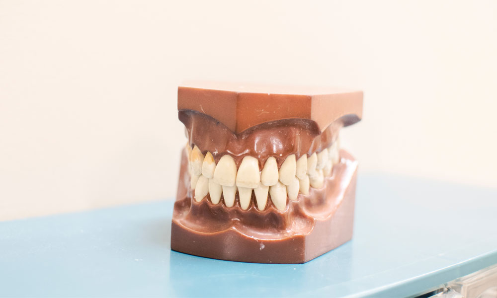 Dentadura humana